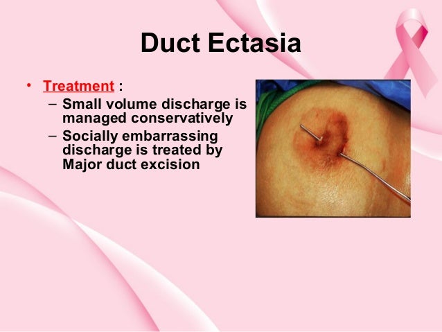 breast duct discharge Pussy shaving katya